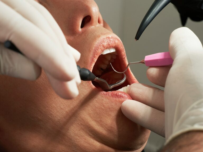 Sådan overvinder du din tandlægeskræk